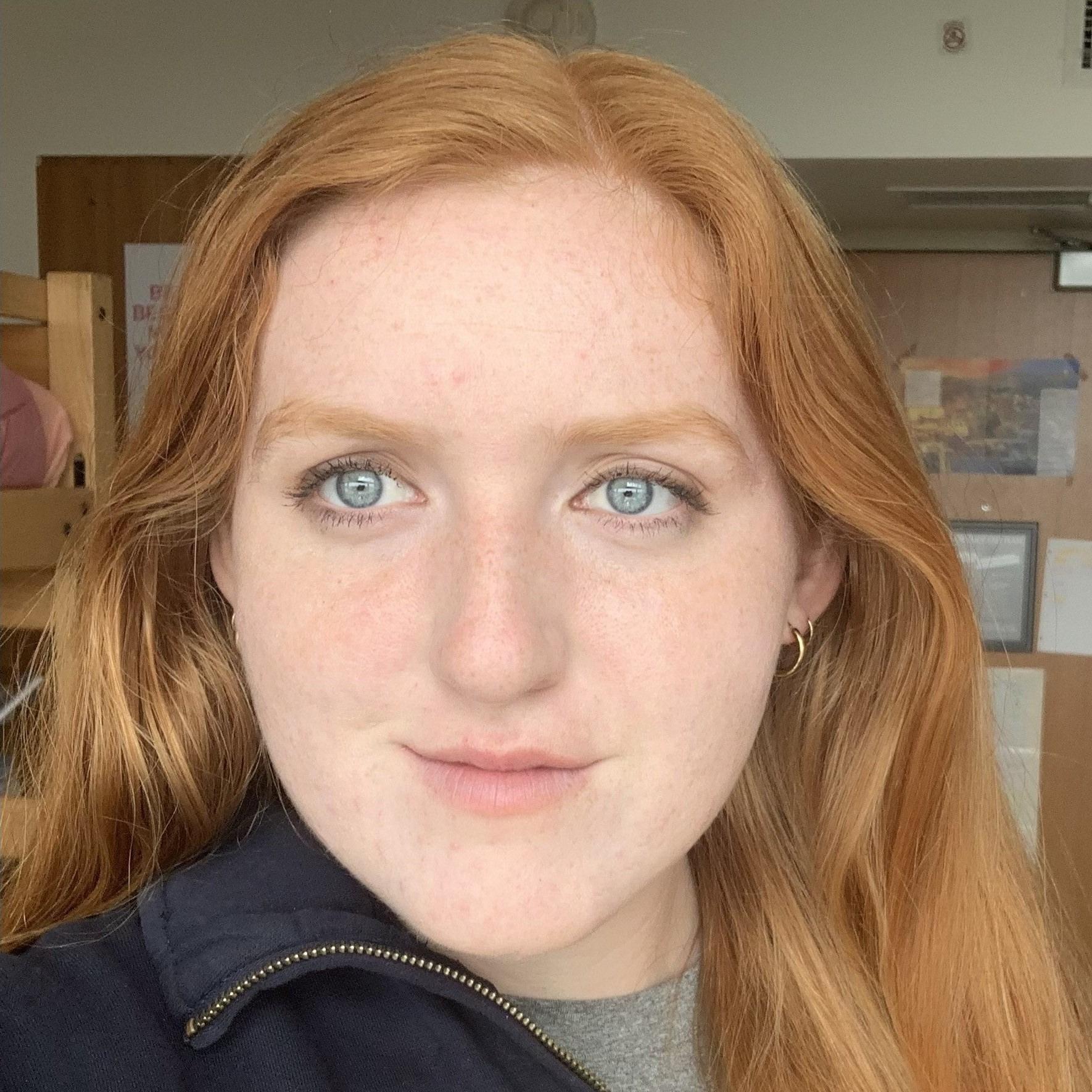 Amy Arnes Profile Image