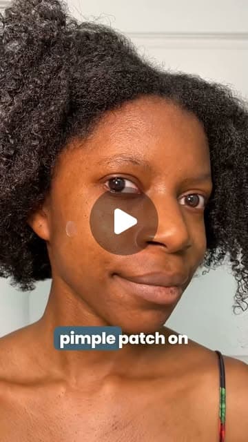 Blue Oasis | Choose the most gentle and seamless way to self-confidence and eliminate painful pimples overnight with Blue Oasis Acne Pimple Patches. ✨... | Instagram