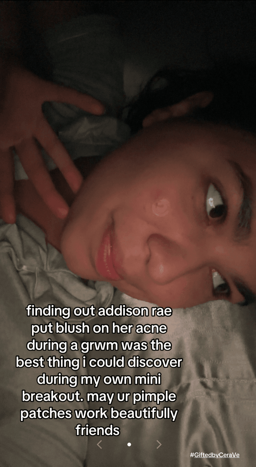 Gifted By Cerave Blemish Patches